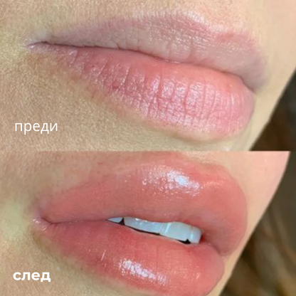 Lip Plumper - Уголемяващ Гланц За Устни