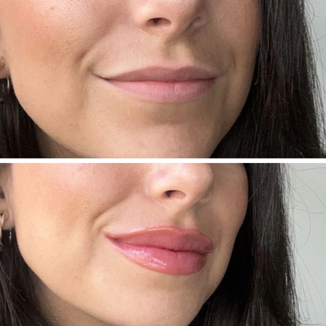 Lip Plumper - Уголемяващ Гланц За Устни