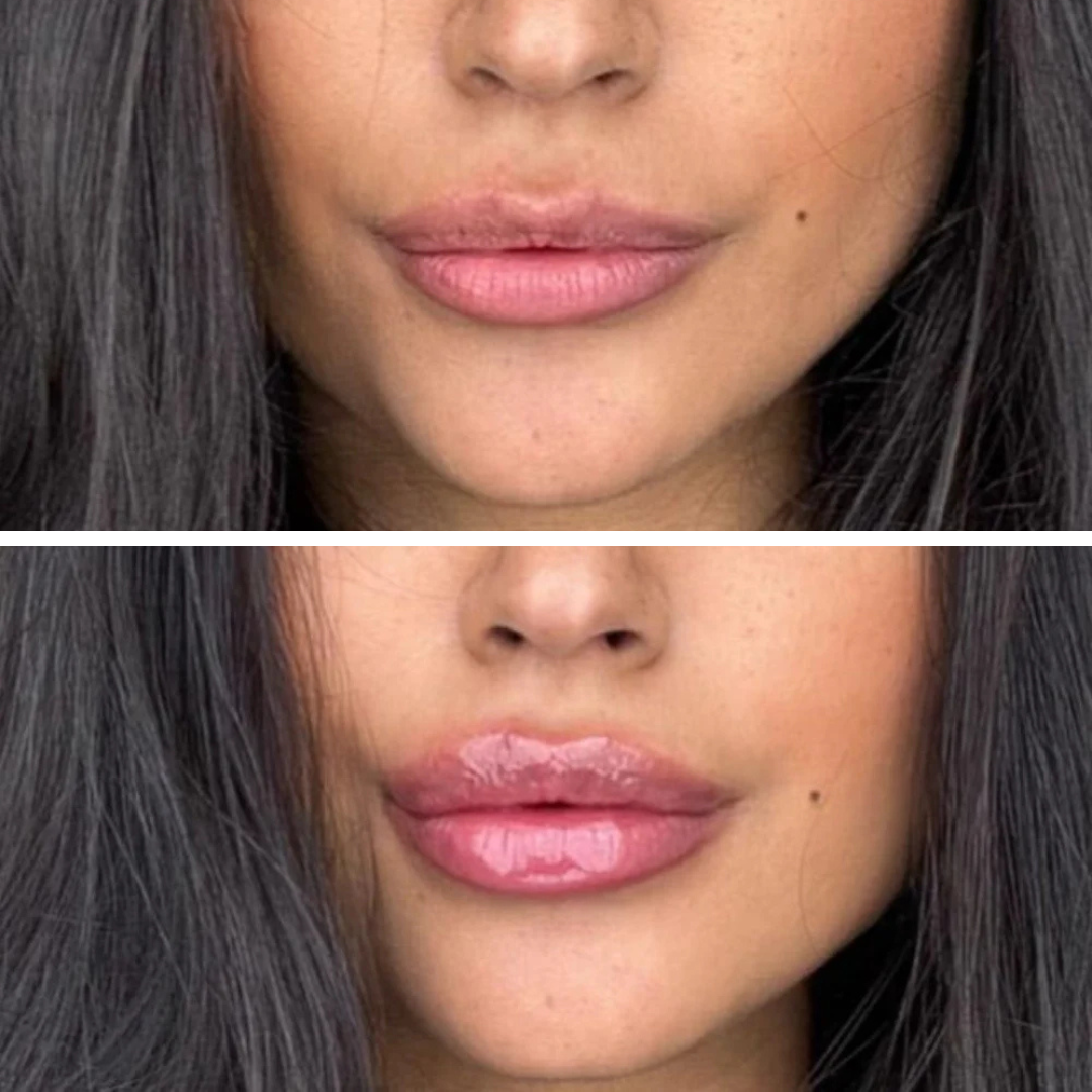 Lip Plumper - Уголемяващ Гланц За Устни