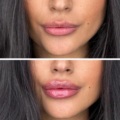 Lip Plumper - Уголемяващ Гланц За Устни